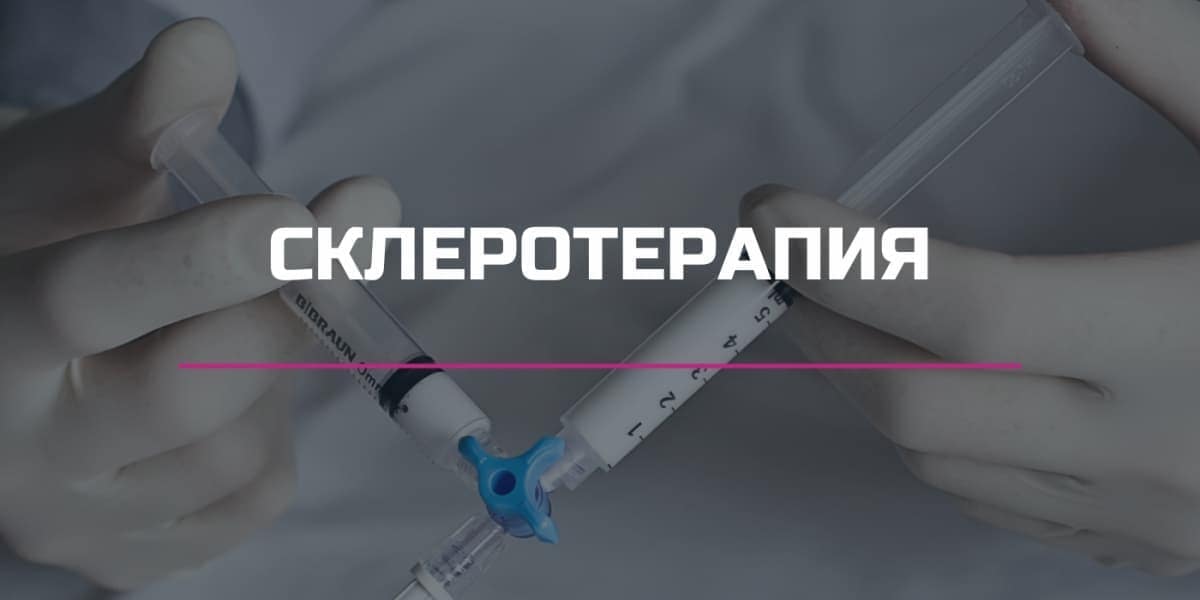 Удаление сосудистой сетки — Варикоза нет, клиника лазерной хирургии в ...